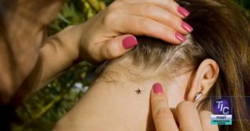Як убезпечити себе від сезонних захворювань від укусів комах
